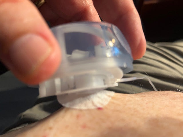 Cannula Securing Tool - Prevent Bent Cannulas and Infusion-Set Tenting